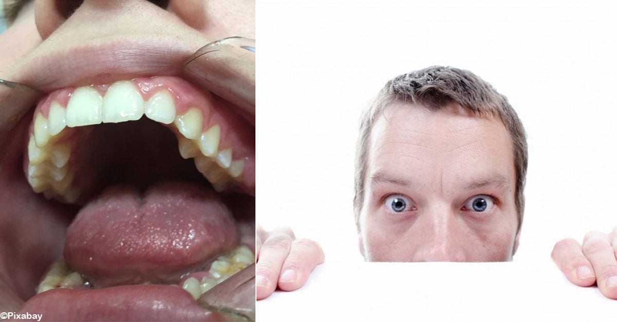 Shocking Tonsil Facts Learn To Identify Them All - mntv1z2