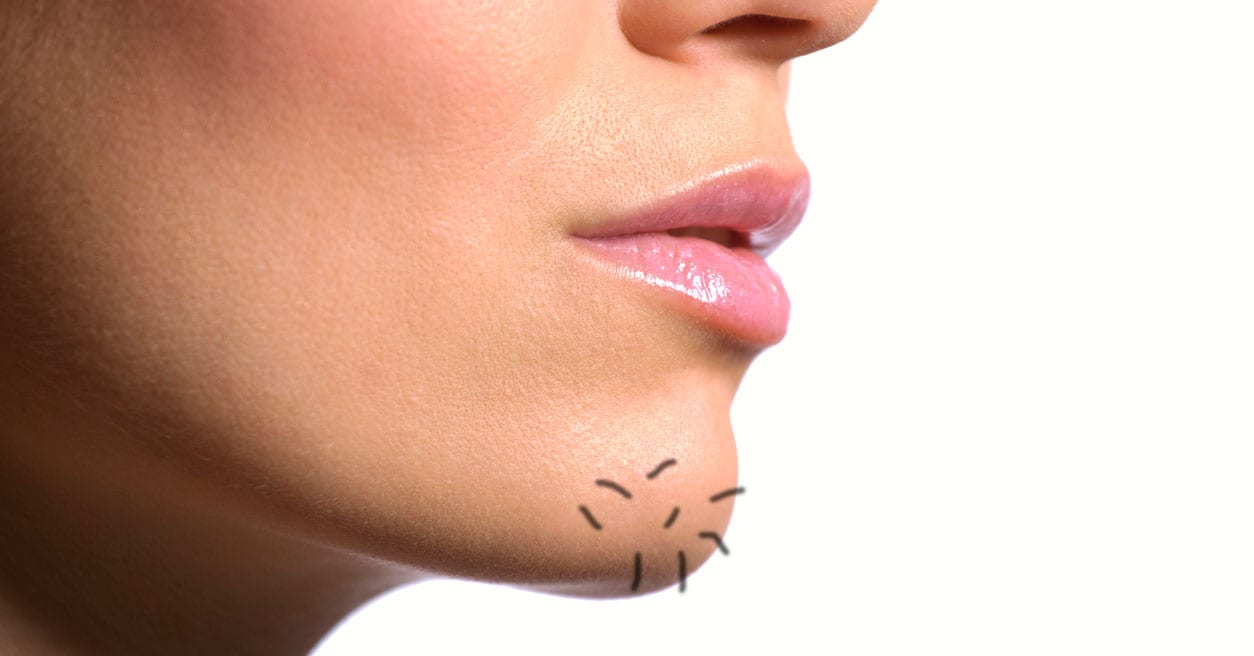 Chin Hairs Can Pop up Fast Here’s How to Uproot Them