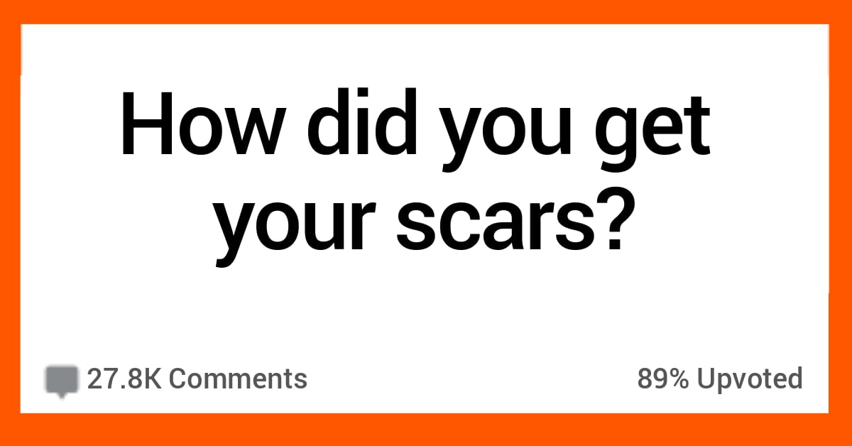 FUN FACTS ABOUT SCARS visual data 8