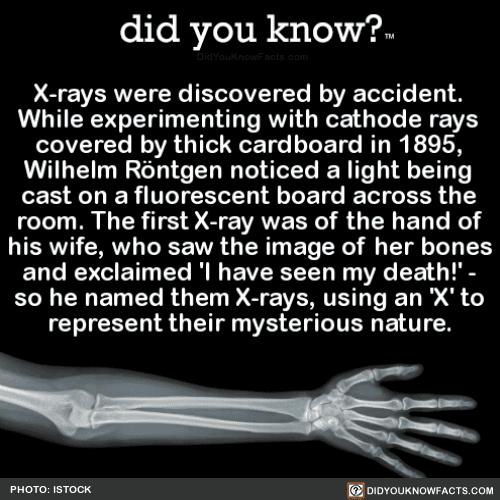 x-rays-were-discovered-by-accident-while-did-you-know