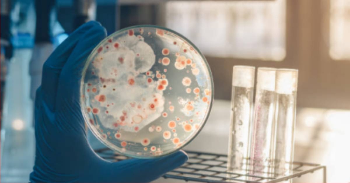 How Long Does Mrsa Stay Alive On Surfaces at John Marchetti blog