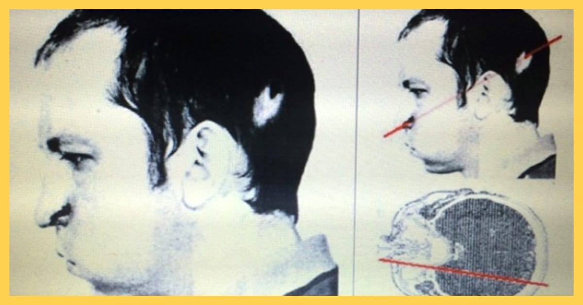 Meet the Man Who Put His Head Inside a Particle Accelerator and Survived