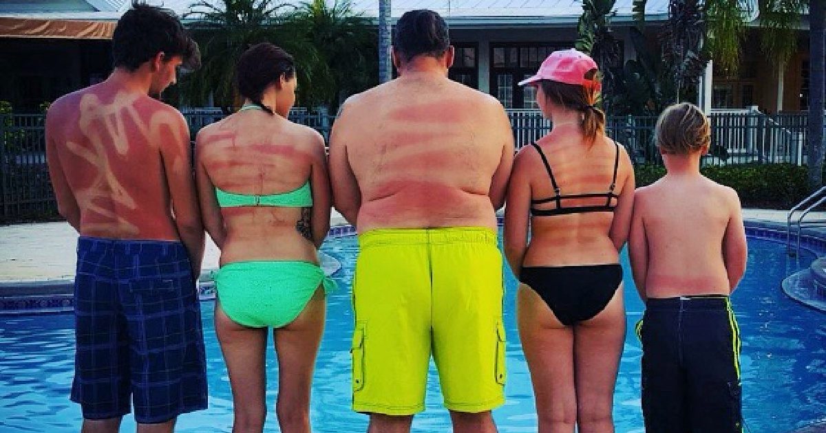 12 People Who Learned the Hard Way How to Use SprayOn Sunscreen